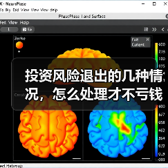 投资风险退出的几种情况，怎么处理才不亏钱？（图2）